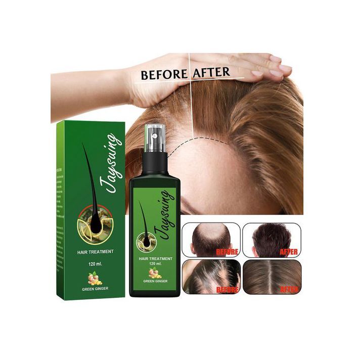 Jaysuing huile Cheveux Anti Chute -Traitement pour la Croissance et Repousse des Cheveux