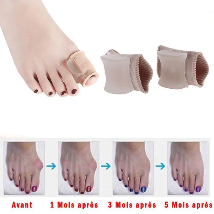 Correcteur orthopédique pour hallux Valgus