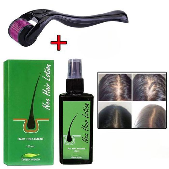 Pack Derma Roller - Anti-chute - 120 ml - Huile repousse cheveux - Stimule cuir chevelu - Brillance améliorée