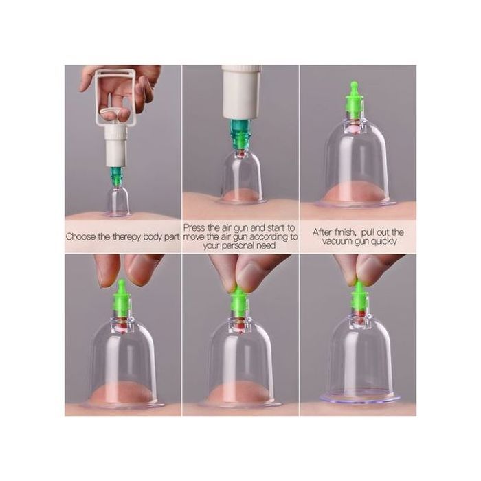 ensemble de tasses à ventouses professionnelles de Relaxation