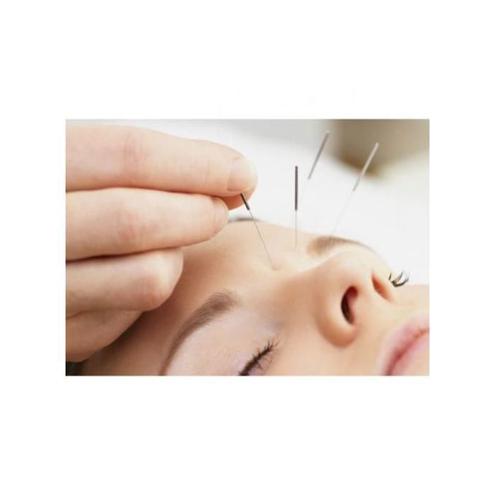 Aiguille d'acupuncture - Non spécifié - 100 pcs - Jetable - Tube inclus - Taille 0.25x13mm