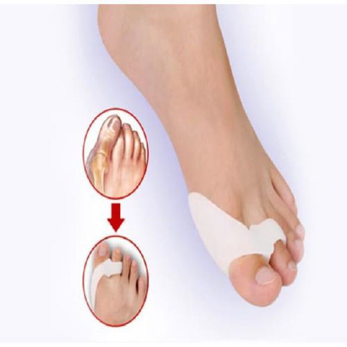 1 Paire correcteur d'oignon, protecteur des gros orteils, hallux valgus