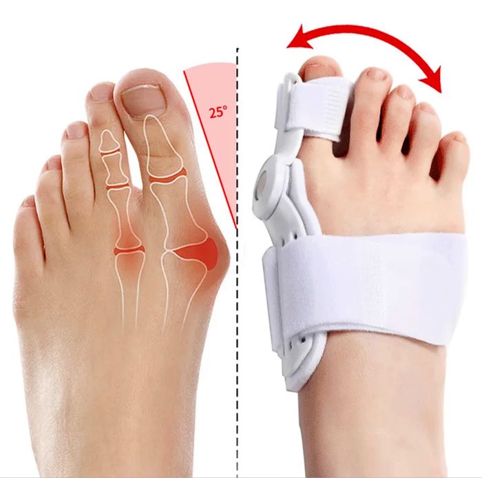 correction d'orteil hallux valgus schiene correcteur dorteil pour pieds médicale