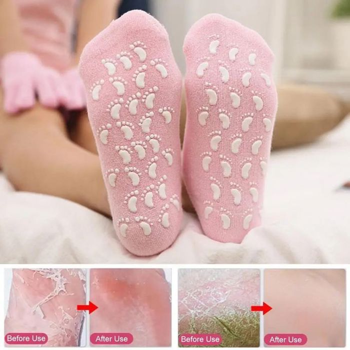 Chaussettes hydratantes en gel - GENERIC - Réutilisables - Exfoliantes - Confortables - Non comédogène