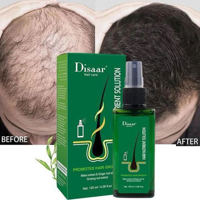 Sérum de croissance des cheveux - Disaar - Vaporisateur 120 ml - Anti-chute - Tous types de cheveux - Unisexe