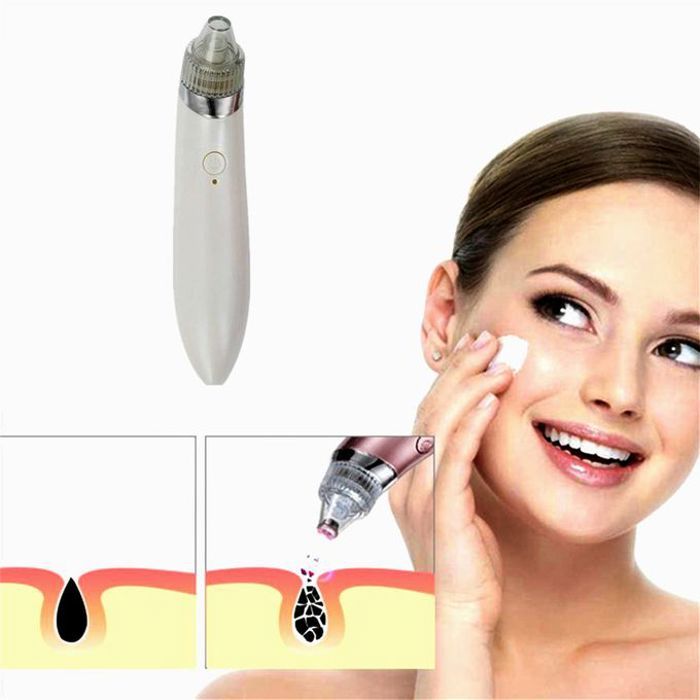 Aspirateur Points Noirs - Adieu Imperfections !