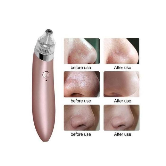 Aspirateur Points Noirs Rechargeable : Peau Nettoyée & Radieuse - Pour Hommes & Femmes - Haute Qualité