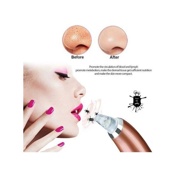 Aspirateur à Points Noirs : Peau Nettoyée en Profondeur et Éclatant