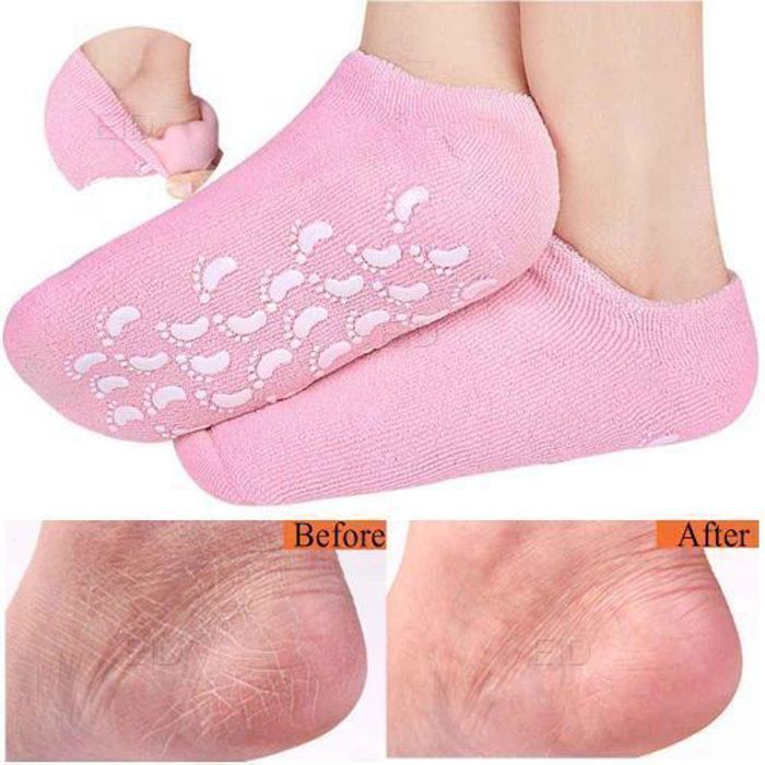Chaussettes Gel Spa - GENERIC - 2 Paires - Répare et Adoucit - Non Comédogène - couleur aliatoire