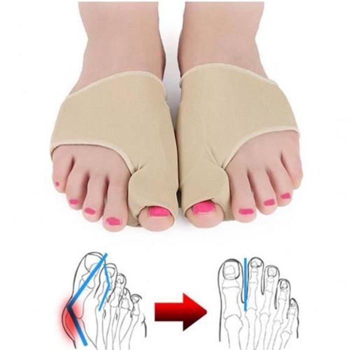 Correcteur d'hallux Valgus orthopédique,1 paire, Correction-Correcteur des doigts Pieds