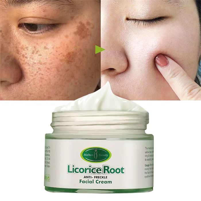 Crème hydratante pour visage à base de réglisse, Anti-tache de rousseur, blanchissant, anti-rides