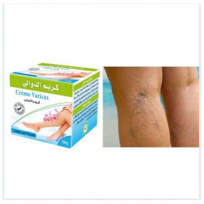 Crème des varices - Bio - 80g - 100% naturel - Stimule circulation - Réduit gonflement