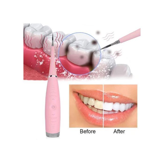 Détartreur dentaire électrique, Recharge USB, outil de nettoyage pour le tartre