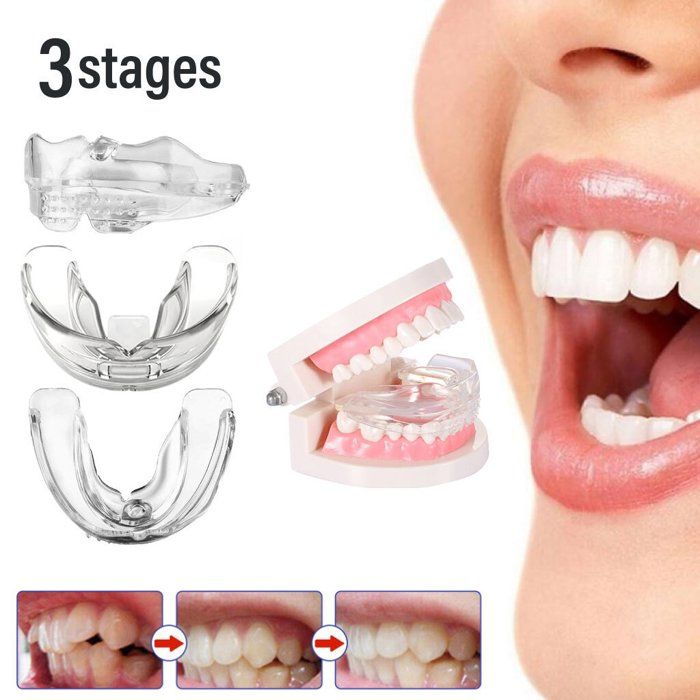 Correcteur Orthodontique Dentaire Transparent En Silicone Pour Redressement Des Dents. ( Pack de 3 Stages . )