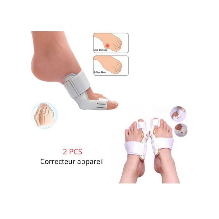 Pack 2 Correcteur appareil d'oignons pour femmes Correcteurs