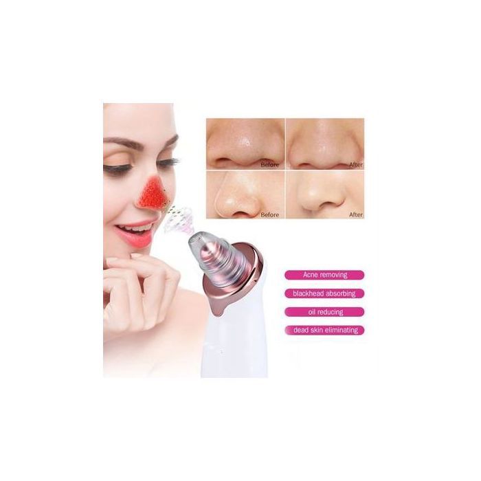 Aspirateur électrique pour éliminer les points noirs, nettoyeur de pores