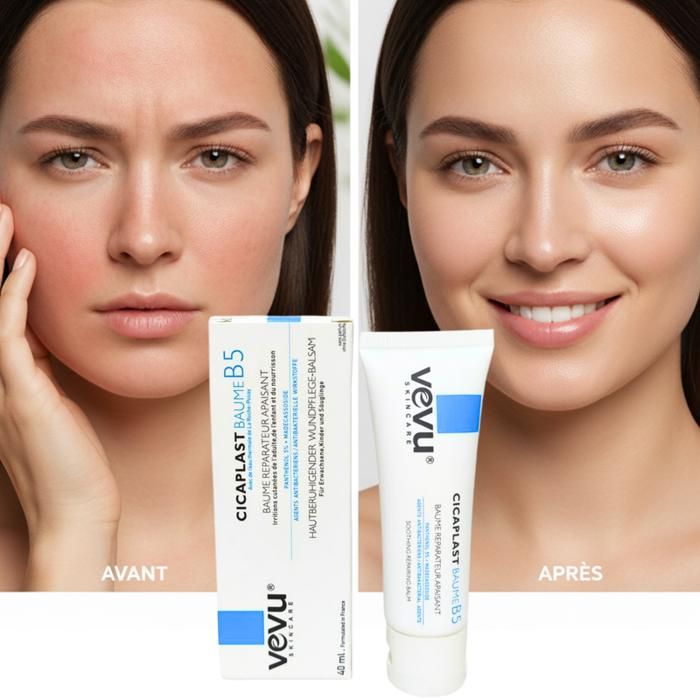 Soin réparateur - VEVU - Cicaplast Baume B5+ - Ultra-réparateur - Apaisant - 100 ml