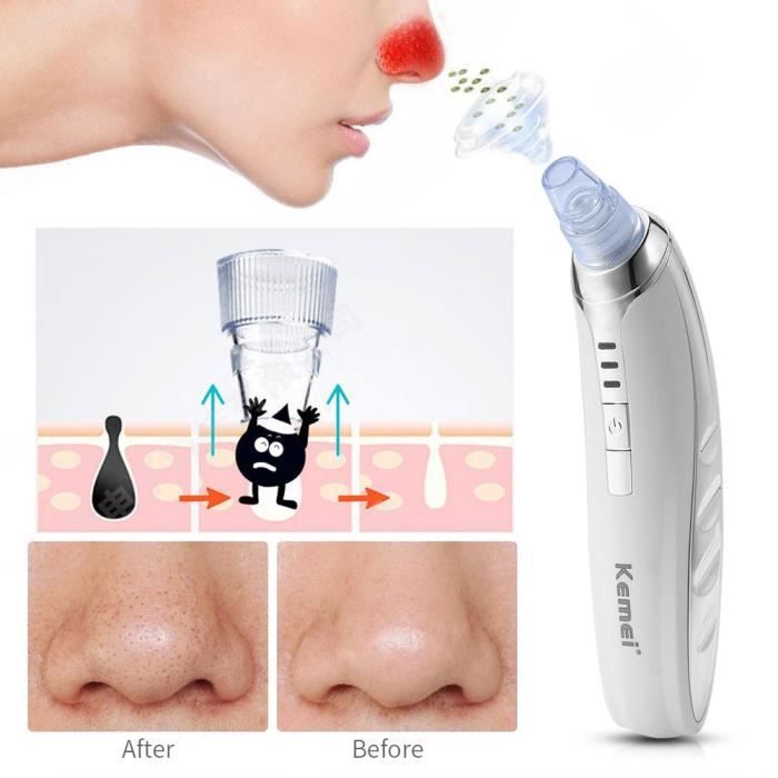 Aspirateur visage point noirs enlèvement cutine soins de la peau faciale multifonction